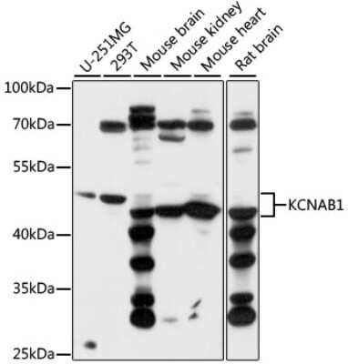 Western Blot: KvBeta1 AntibodyAzide and BSA Free [NBP3-03639]