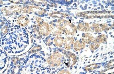 Immunohistochemistry-Paraffin: KvBeta2 Antibody [NBP1-80272]