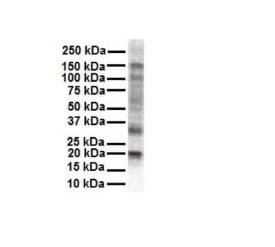 Western Blot: KvBeta2 Antibody [NBP1-80096]