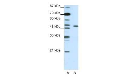 Western Blot: KvBeta2 Antibody [NBP1-80271]