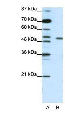 Western Blot: KvBeta2 Antibody [NBP1-80272]