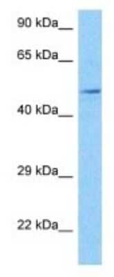 Western Blot: KvBeta2 Antibody [NBP3-09958]