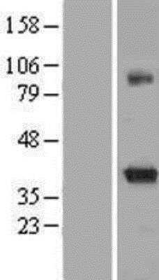 Western Blot: KvBeta2 Overexpression Lysate [NBP2-05196]