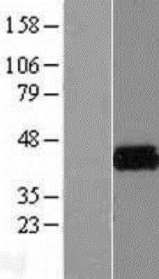 Western Blot: KvBeta2 Overexpression Lysate [NBP2-07973]