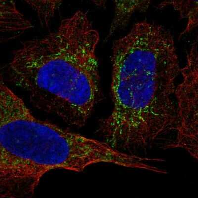 Immunocytochemistry/ Immunofluorescence: KvBeta3 Antibody [NBP2-58857]