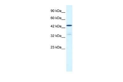 Western Blot: KvBeta3 Antibody [NBP2-83134]