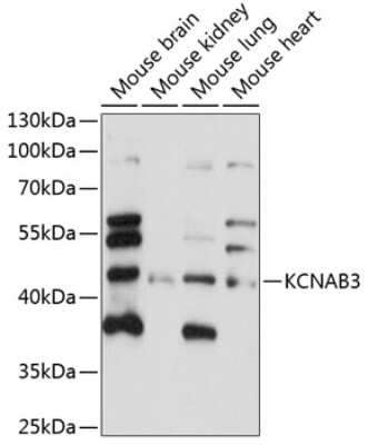 Western Blot: KvBeta3 AntibodyAzide and BSA Free [NBP3-03643]