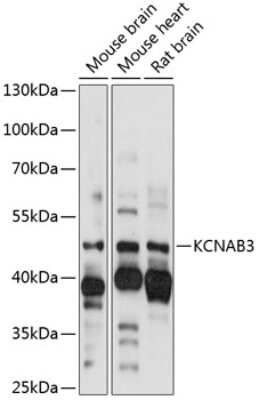 Western Blot: KvBeta3 AntibodyAzide and BSA Free [NBP3-03644]