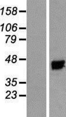 Western Blot: KvBeta3 Overexpression Lysate [NBP2-07834]