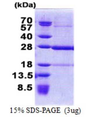 SDS-PAGE: Recombinant Human KxDL motif containing 1 His Protein [NBP2-23177]