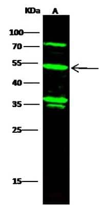 Western Blot: Kynureninase Antibody (004) [NBP2-90525]