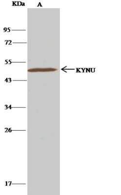 Immunoprecipitation: Kynureninase Antibody (062) [NBP2-89680]