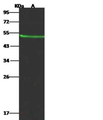 Western Blot: Kynureninase Antibody (062) [NBP2-89680]