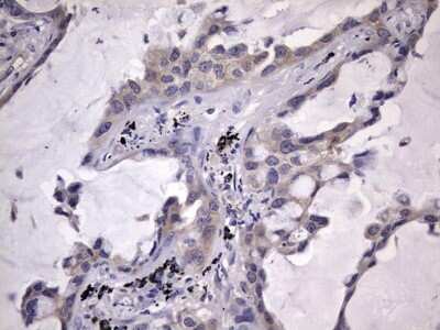Immunohistochemistry: Kynureninase Antibody (OTI1H1) [NBP2-45579]