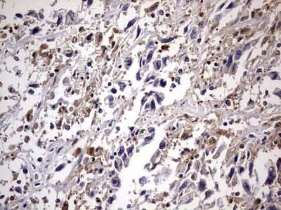 Immunohistochemistry: Kynureninase Antibody (OTI1H1) [NBP2-45579]