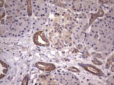 Immunohistochemistry: Kynureninase Antibody (OTI1H1) [NBP2-45579]