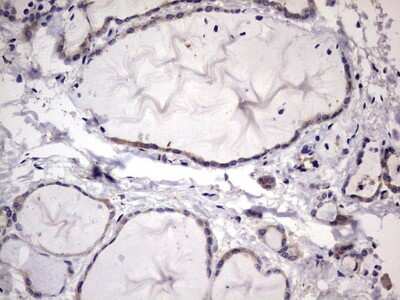 Immunohistochemistry: Kynureninase Antibody (OTI1H1) [NBP2-45579]