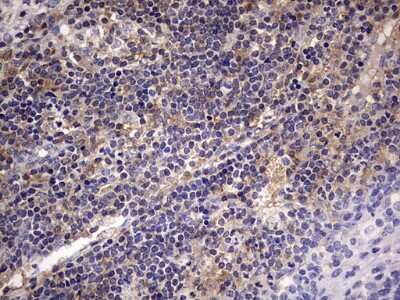 Immunohistochemistry: Kynureninase Antibody (OTI1H1) [NBP2-45579]