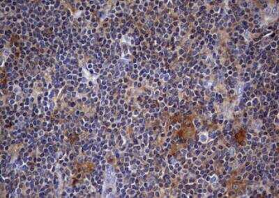 Immunohistochemistry-Paraffin: Kynureninase Antibody (OTI1H1) [NBP2-45579]