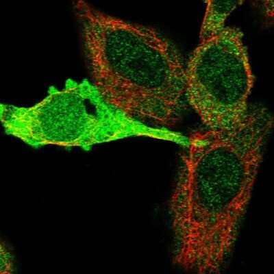 Immunocytochemistry/ Immunofluorescence: Kynureninase Antibody [NBP2-14180]