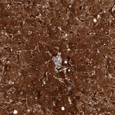 Immunohistochemistry-Paraffin: Kynureninase Antibody [NBP2-14180]