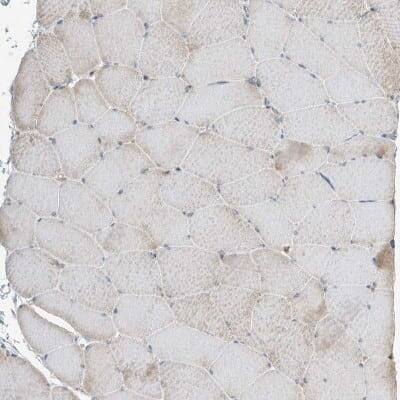 Immunohistochemistry-Paraffin: Kynureninase Antibody [NBP2-14180]
