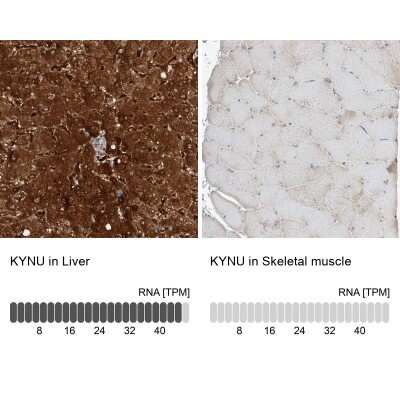 Immunohistochemistry-Paraffin: Kynureninase Antibody [NBP2-14180]