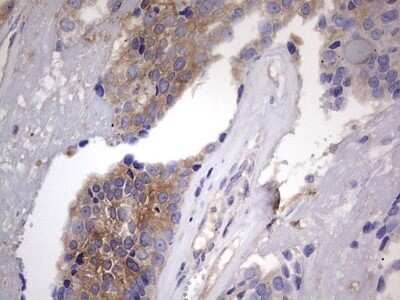 Immunohistochemistry: Kynureninase Antibody (OTI1H1) - Azide and BSA Free [NBP2-71400]