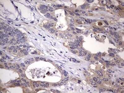 Immunohistochemistry: Kynureninase Antibody (OTI1H1) - Azide and BSA Free [NBP2-71400]