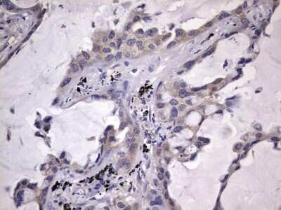 Immunohistochemistry: Kynureninase Antibody (OTI1H1) - Azide and BSA Free [NBP2-71400]