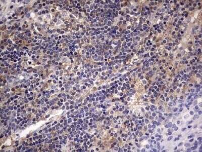 Immunohistochemistry: Kynureninase Antibody (OTI1H1) - Azide and BSA Free [NBP2-71400]
