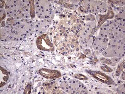 Immunohistochemistry: Kynureninase Antibody (OTI1H1) - Azide and BSA Free [NBP2-71400]