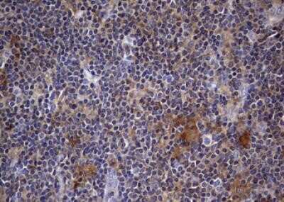 Immunohistochemistry: Kynureninase Antibody (OTI1H1) - Azide and BSA Free [NBP2-71400]