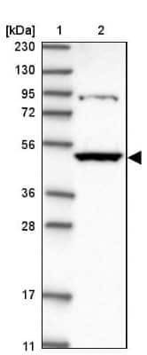 Western Blot: Kynureninase Antibody [NBP2-14180]