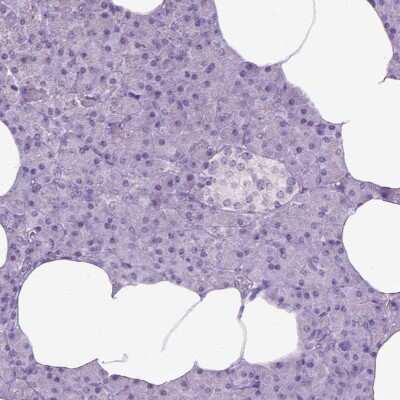 Immunohistochemistry-Paraffin: Kynurenine 3-Monooxygenase/KMO Antibody [NBP1-86335]