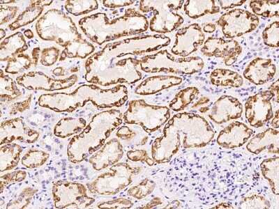 Immunohistochemistry-Paraffin: Kynurenine 3-Monooxygenase/KMO Antibody [NBP2-97709]