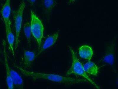 Immunocytochemistry/ Immunofluorescence: L1CAM Antibody (014) [NBP2-89294]