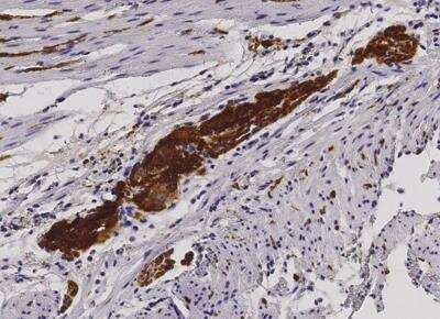 Immunohistochemistry-Paraffin: L1CAM Antibody (014) [NBP2-89294]
