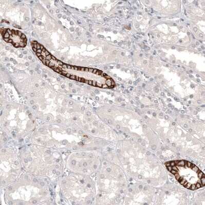 Immunohistochemistry-Paraffin: L1CAM Antibody (CL12984) [NBP3-18568]