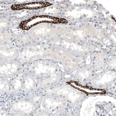 Immunohistochemistry-Paraffin: L1CAM Antibody (CL12988) [NBP3-18553]