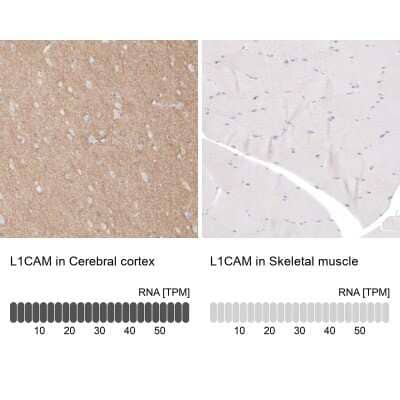 Immunohistochemistry-Paraffin: L1CAM Antibody [NBP1-86544]