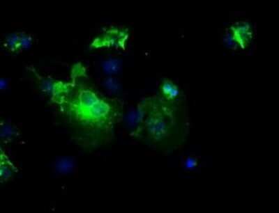 Immunocytochemistry/ Immunofluorescence: L1CAM Antibody (OTI2A6) - Azide and BSA Free [NBP2-71097]