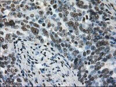 Immunohistochemistry: L1CAM Antibody (OTI2A6) - Azide and BSA Free [NBP2-71097]