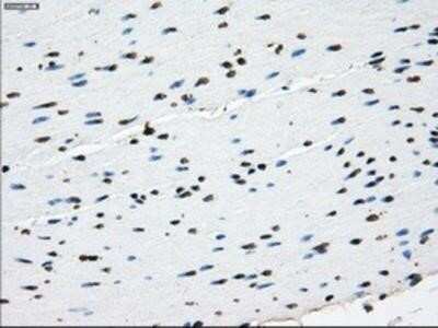 Immunohistochemistry: L1CAM Antibody (OTI2A6) - Azide and BSA Free [NBP2-71097]