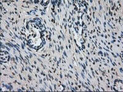 Immunohistochemistry: L1CAM Antibody (OTI2A6) - Azide and BSA Free [NBP2-71097]