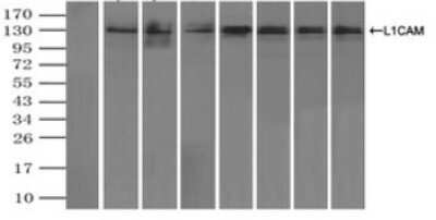 Immunoprecipitation: L1CAM Antibody (OTI2A6) - Azide and BSA Free [NBP2-71097]