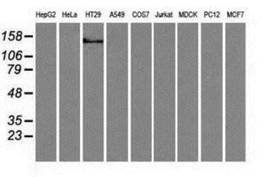 Western Blot: L1CAM Antibody (OTI2A6)Azide and BSA Free [NBP2-71097]