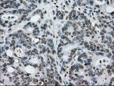 Immunohistochemistry-Paraffin: L1CAM Antibody (OTI2A6) [NBP2-02149]