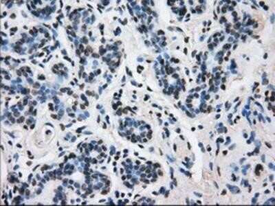 Immunohistochemistry-Paraffin: L1CAM Antibody (OTI2A6) [NBP2-02149]