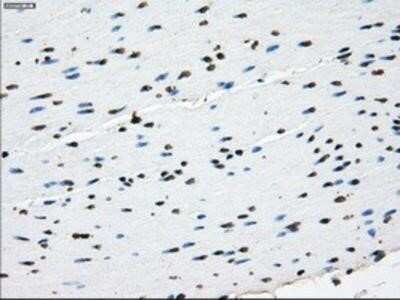 Immunohistochemistry-Paraffin: L1CAM Antibody (OTI2A6) [NBP2-02149]